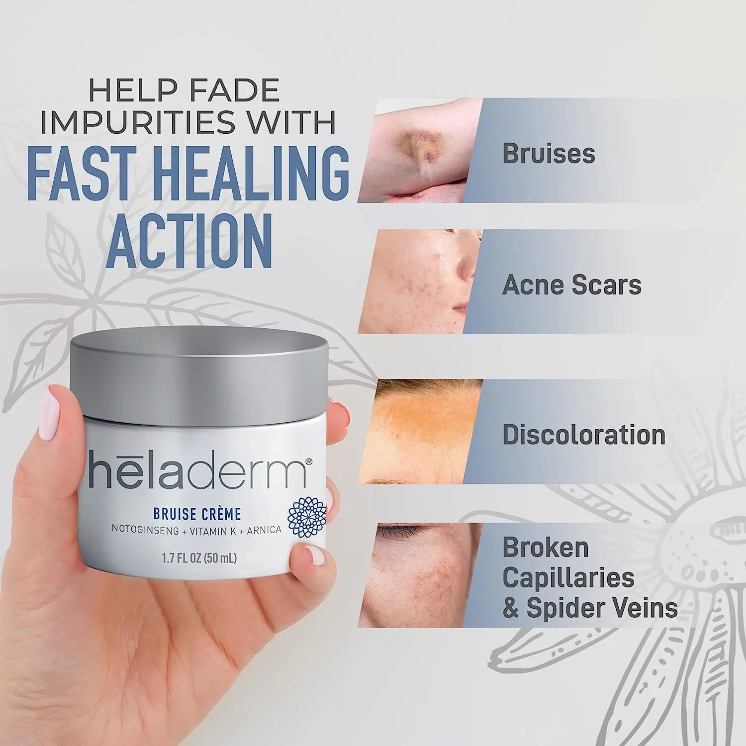 Swelling Rejuvenates 1.7 Skincare, oz Heladerm Oil Skin, Bruise Arnica and Healing, Fast Bruise Cream,