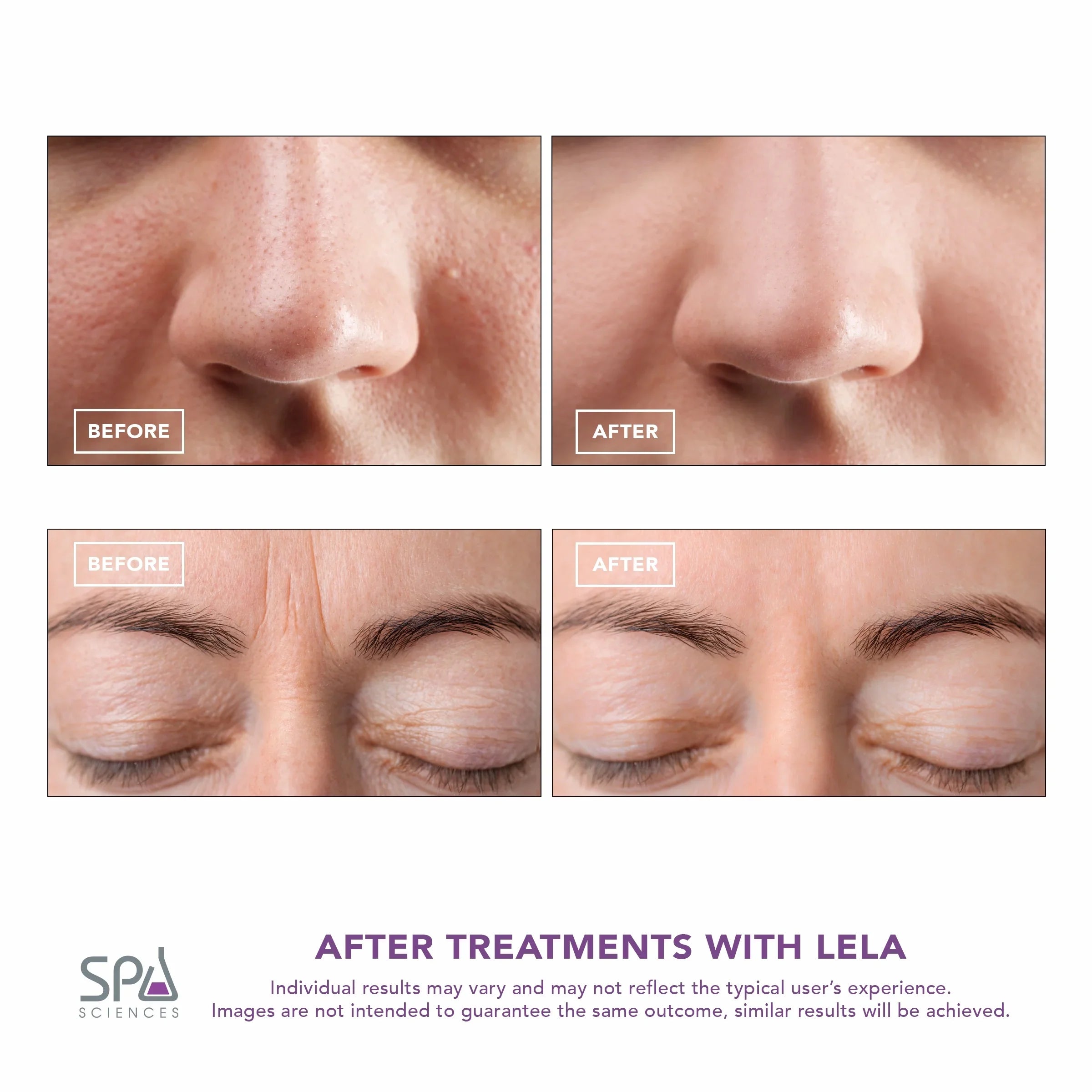 Skin Mint Spa LELA Spatula, Sciences