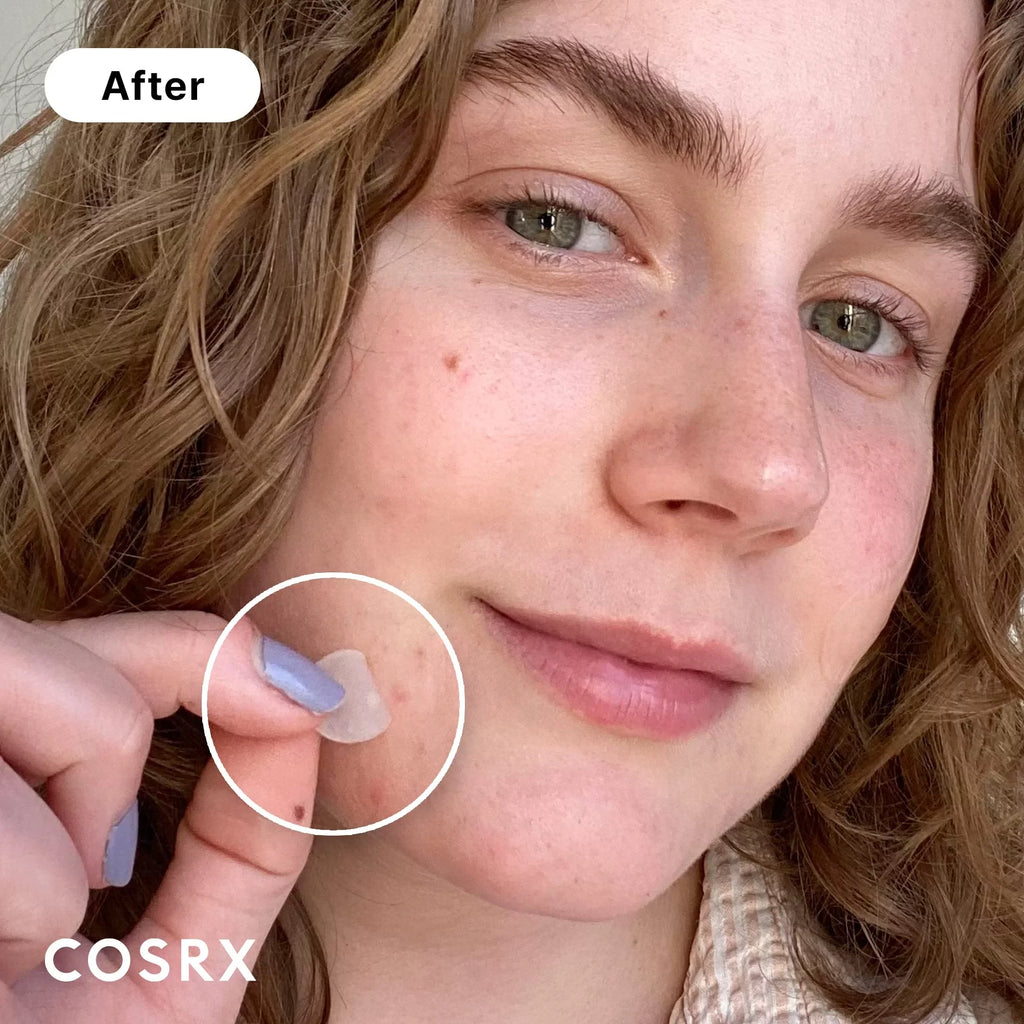 Acne (240 And Cosrx Ingredients Pimple Animals, For Count Hydrocolloid Absorbing Face Cover, Spot For Original Not Zits (Pack. And Size Patches Stickers On No 3 Blemishes Toxic Tested Patch Body,