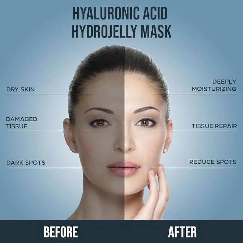 | Skin Natural oz Facial Dark Peel for - All Skin Acid off Treatment fl - Spot Anti-Aging, Hyaluronic Luminous Mask & Pack Mask, Jelly Skin Suitable Professional Lab Reducing 30 Types